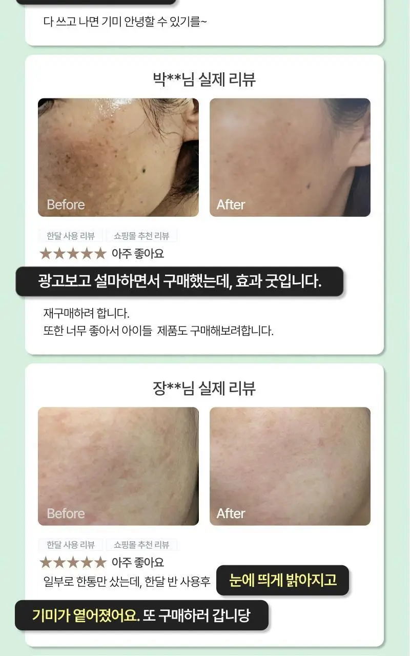 [기미개선] 대웅제약 이지듀 기미잡티앰플 12ml+1ml 기획 상세페이지 11